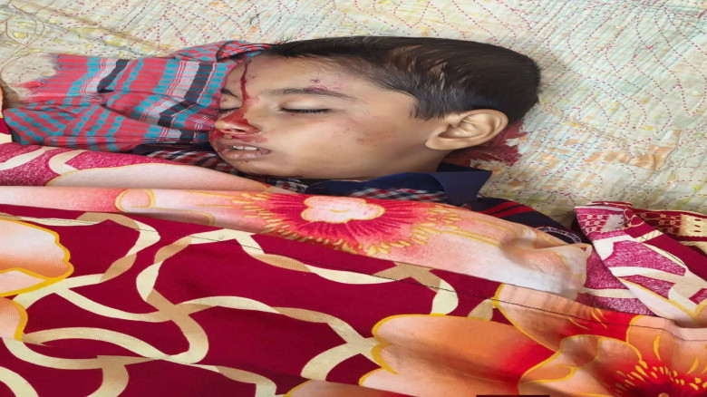 ভোলাহাট ইসলামপুর  এলাকায়  ট্রলির সাথে ধাক্কায় ১ শ...