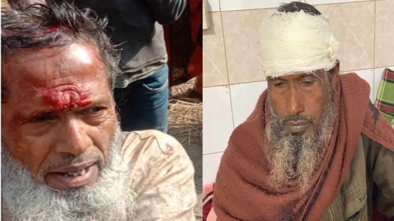 রায়গঞ্জে সাবেক বিএনপি নেতাসহ ৮ জনকে কুপিয়ে জখম কর...