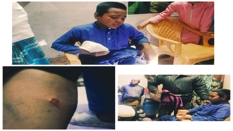 দিঘলিয়া মোড়ল মার্কেটের সড়কে পাগলা কুকুরের উৎপাতে অ...