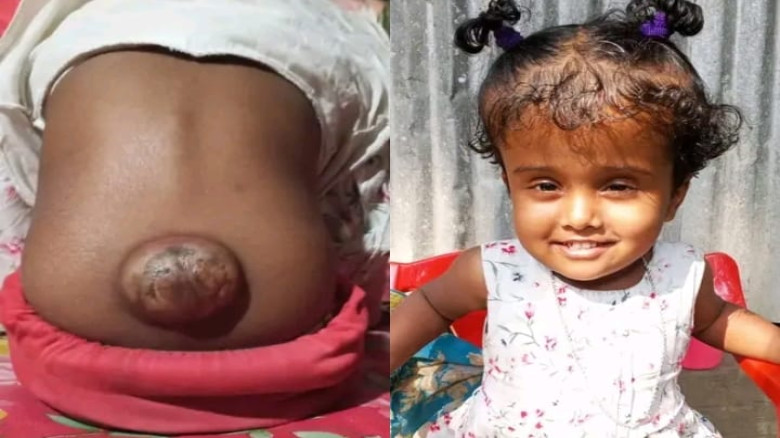 জন্ম থেকে বিরল রোগে আক্রান্ত প্রতিবন্ধী মেয়েকে বাঁ...