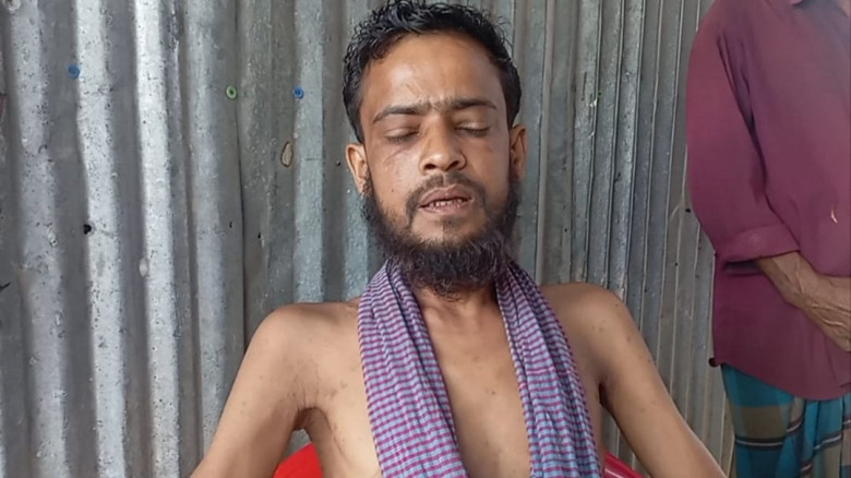 কমলনগরে অসহায় সিএনজি চালক আব্দুর রহিমের বাঁচার আকু...